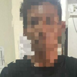 Cemburu, Pria di Gorontalo Diduga Aniaya Korban dengan Badik hingga 15 Tusukan
